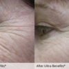 Ultra Benefits - Image 3