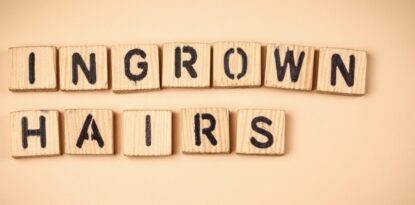 Ingrown Hairs