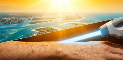 BBL Forever Young Sun Damage Treatment in Sarasota