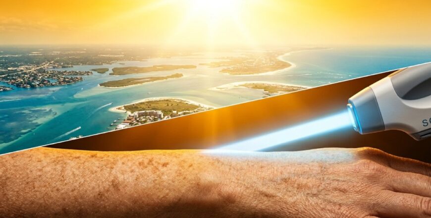 BBL Forever Young Sun Damage Treatment in Sarasota